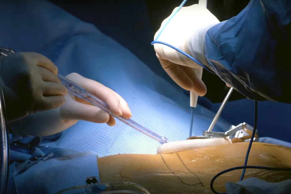 Thoracic Surgery